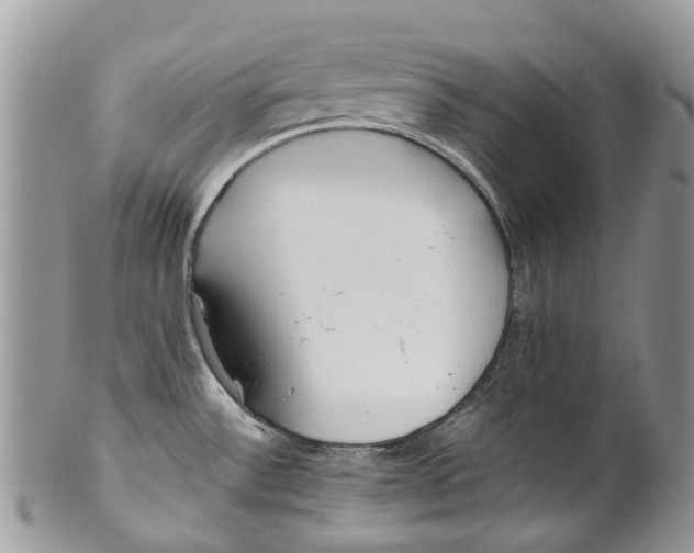 X0000099511532200806051135