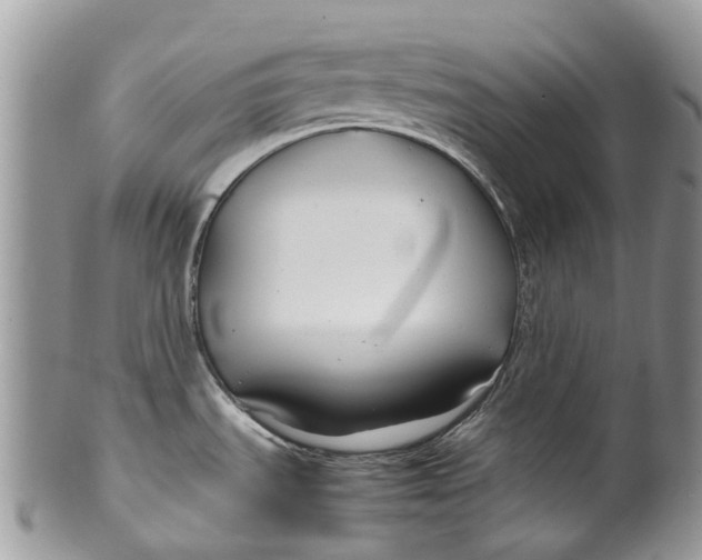 X0000099511535200806051135