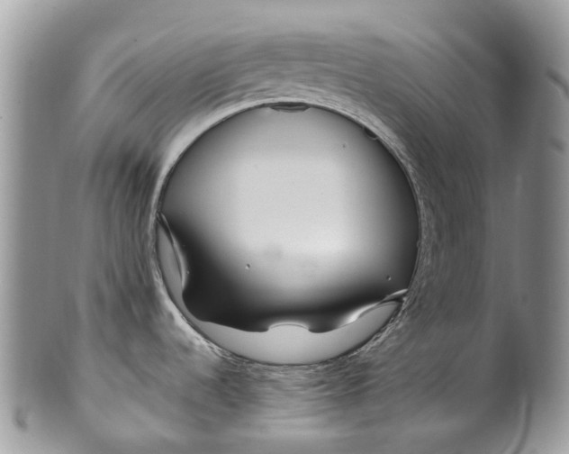 X0000099511536200806051135