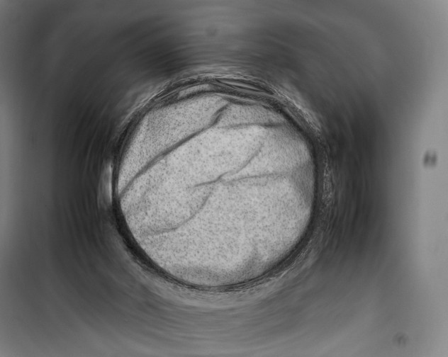 X0000099510014200806121449