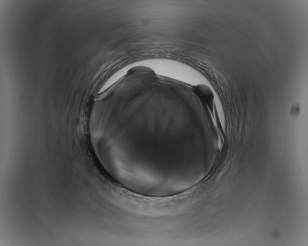 X0000099510035200806121449