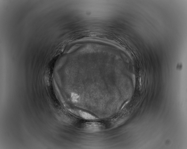 X0000099510316200806121445