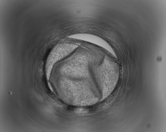 X0000099510319200806121445