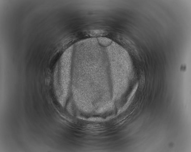 X0000099510367200806121444