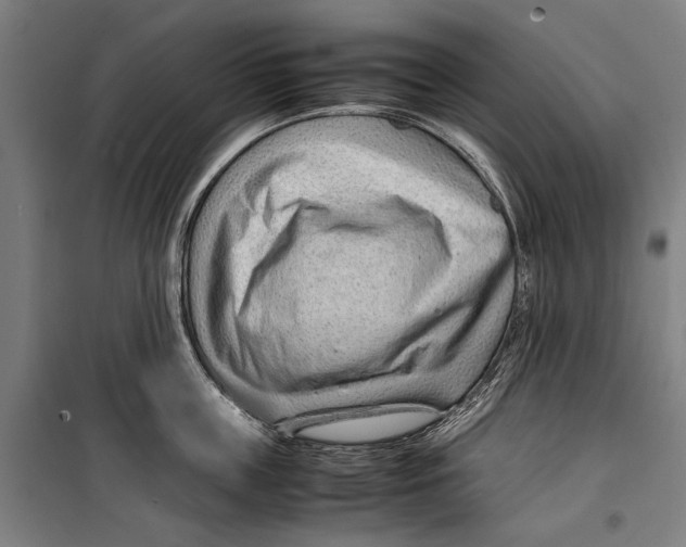 X0000099510859200806121437