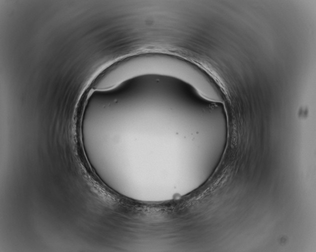 X0000099510976200806121435