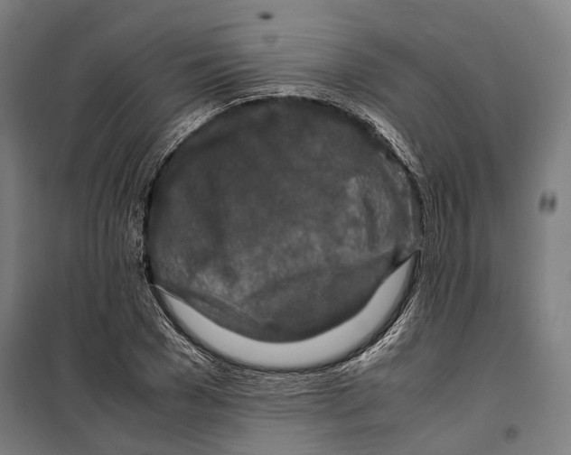 X0000099510977200806121435