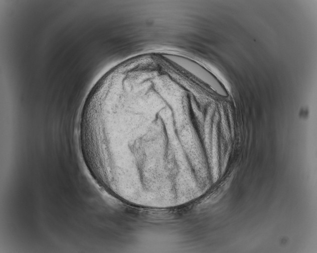 X0000099511007200806121434