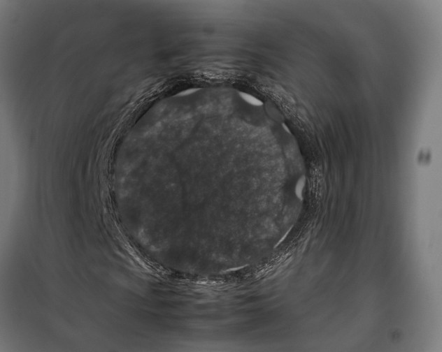 X0000099511009200806121434