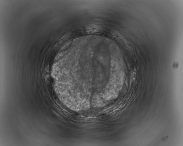 X0000099511011200806121434