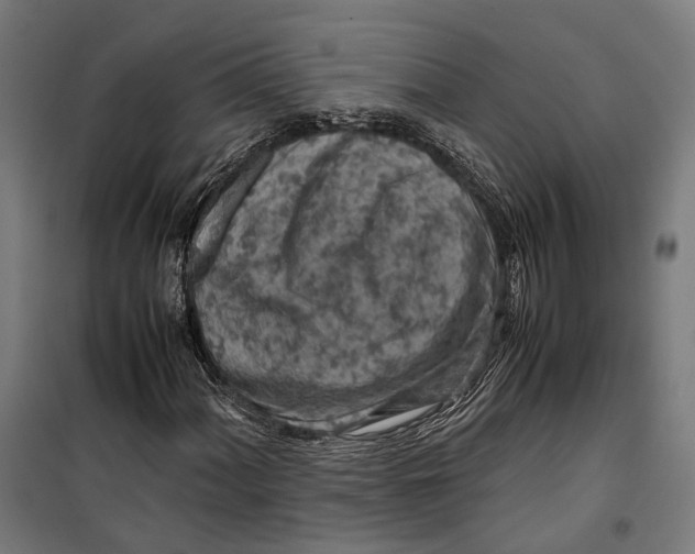 X0000099511060200806121434