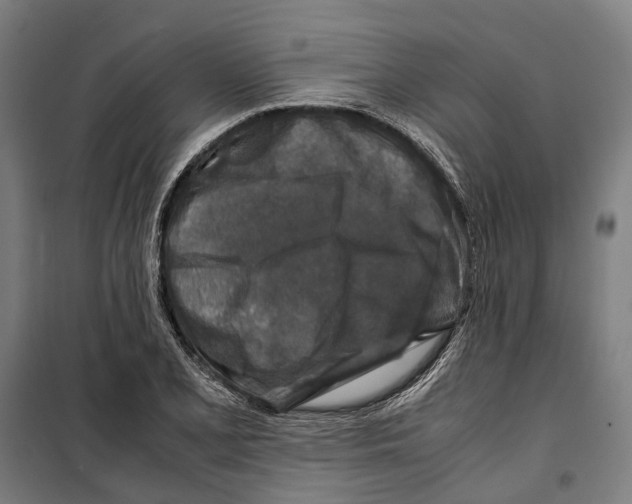 X0000099511077200806121433