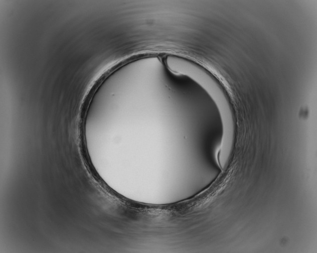 X0000099511085200806121433