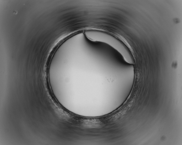 X0000099511133200806121433