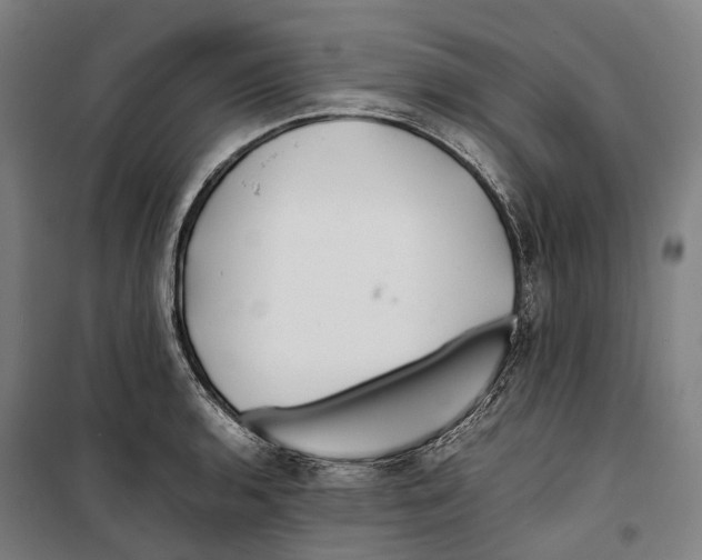 X0000099511136200806121433
