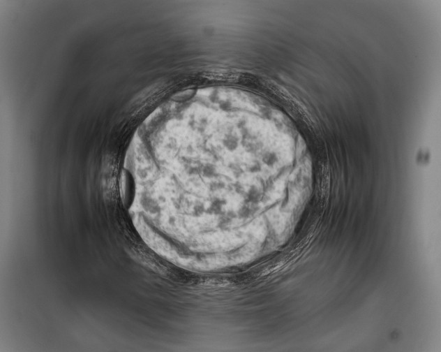 X0000099511154200806121432
