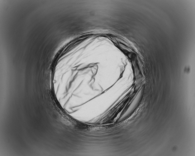 X0000099511171200806121432