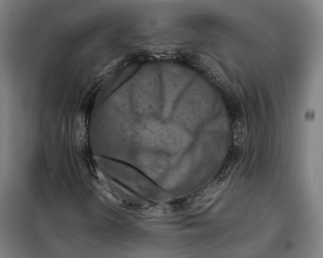 X0000099511298200806121429