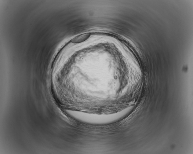 X0000099511371200806121429