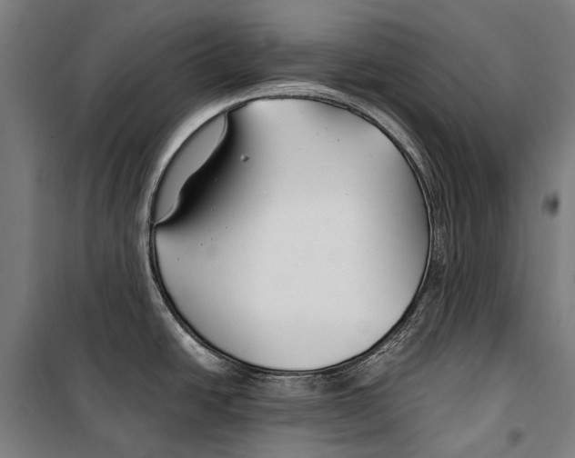 X0000099511438200806121428