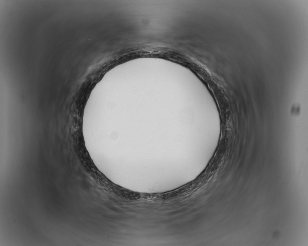 X0000099511447200806121428