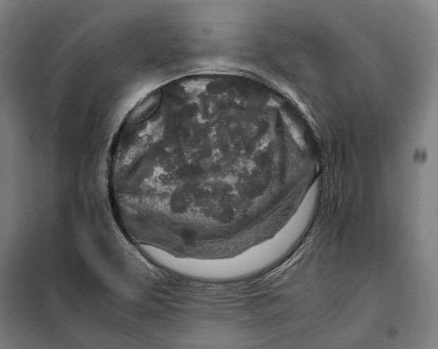 X0000099511463200806121427