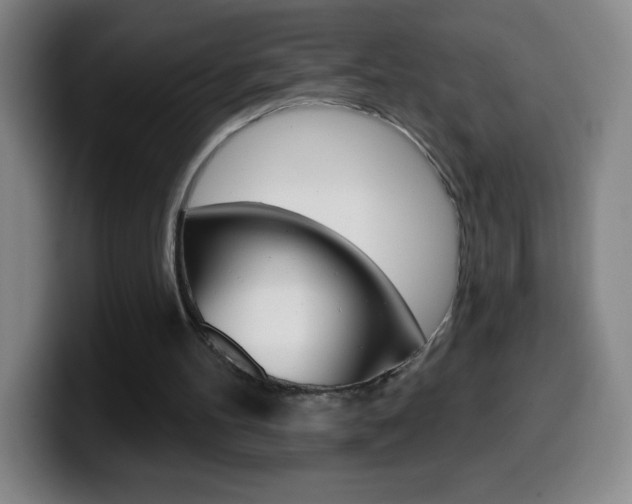 X0000099520100200805151041