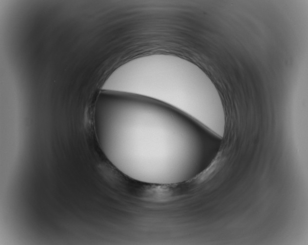 X0000099520140200805151040