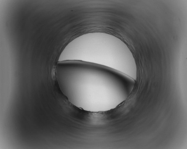 X0000099520141200805151040
