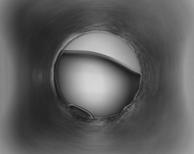 X0000099520148200805151039