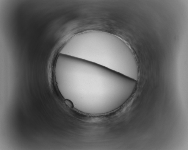 X0000099520149200805151039
