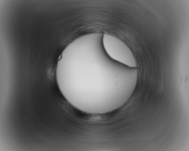 X0000099520177200805151040
