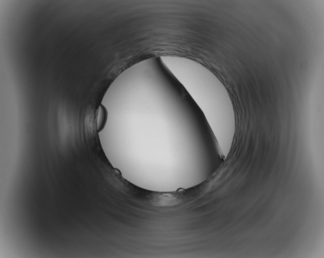X0000099520287200805151039