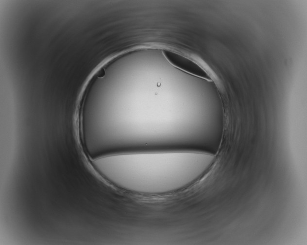 X0000099521100200805151027