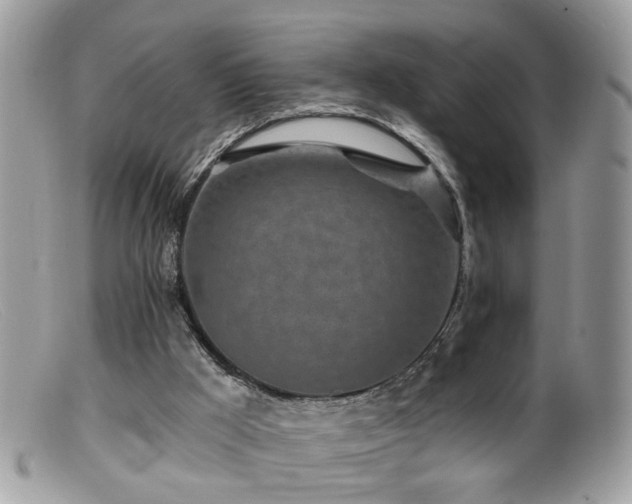 X0000099520009200805151537