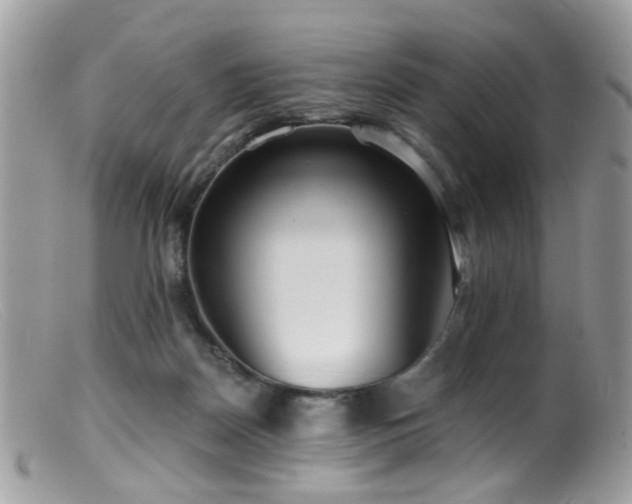 X0000099520170200805151534