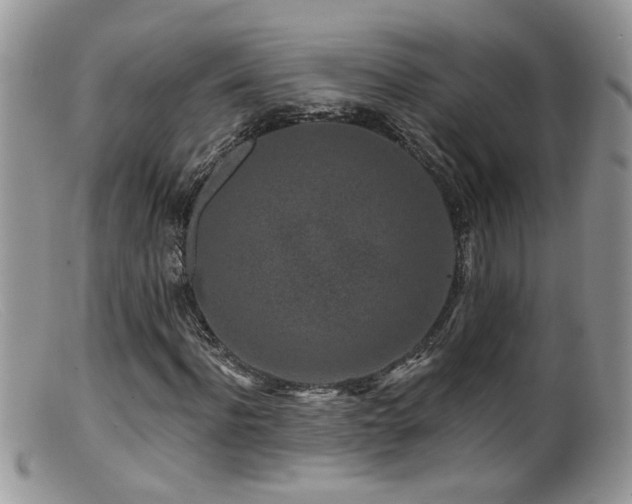 X0000099520916200805151520