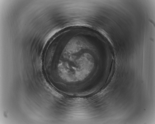 X0000099521024200805151519