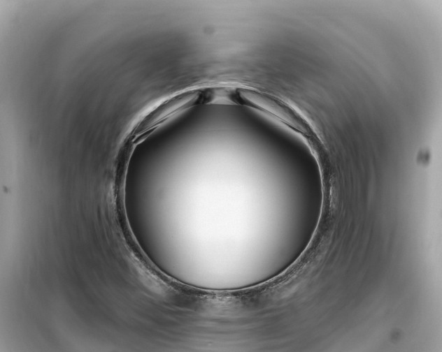 X0000099521452200805221434