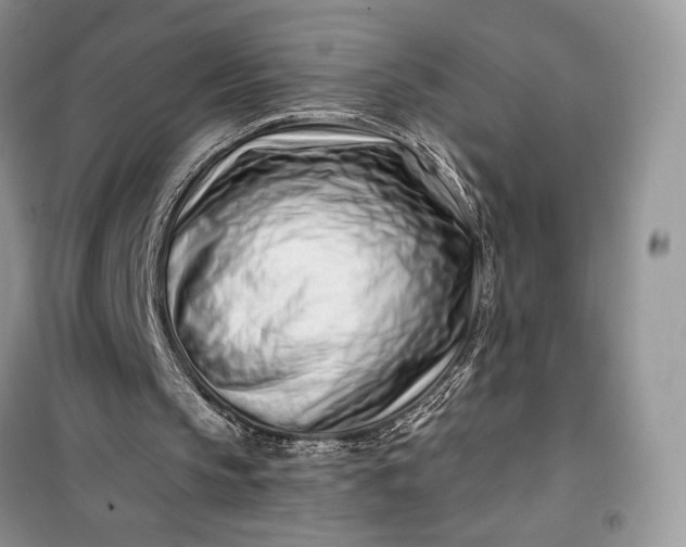 X0000099520145200805291218