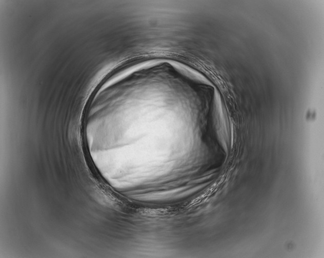 X0000099520147200805291218