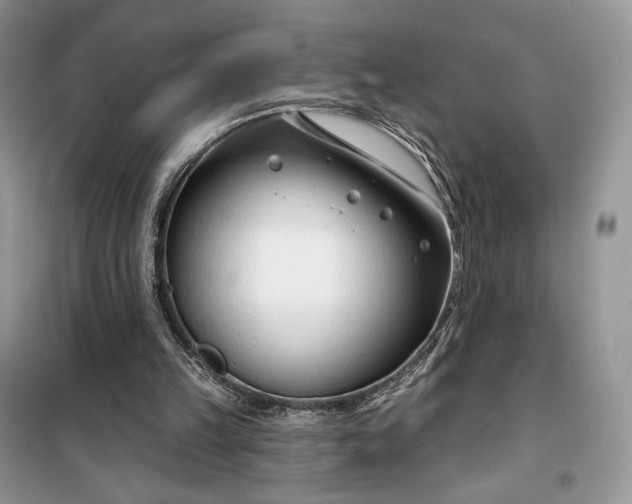 X0000099520149200805291218