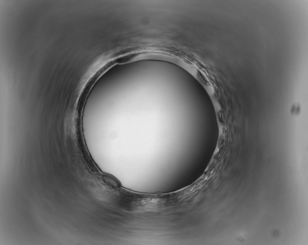 X0000099520152200805291218