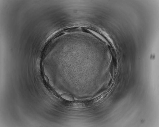 X0000099520154200805291218