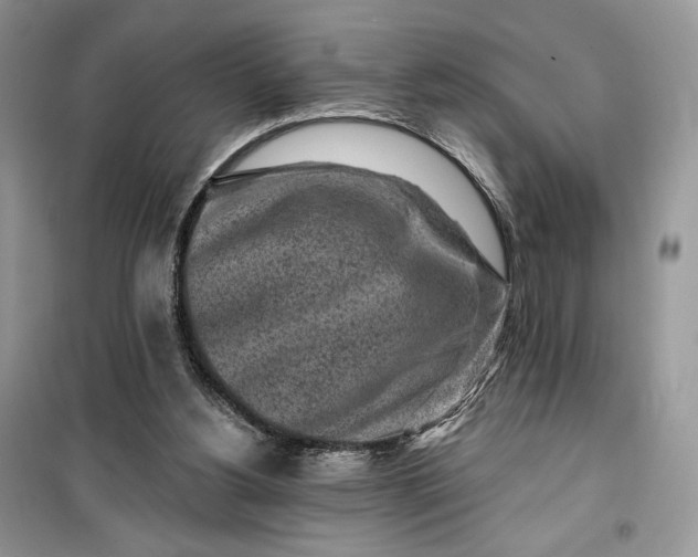 X0000099520156200805291218