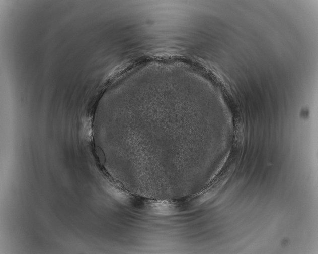 X0000099520383200805291216