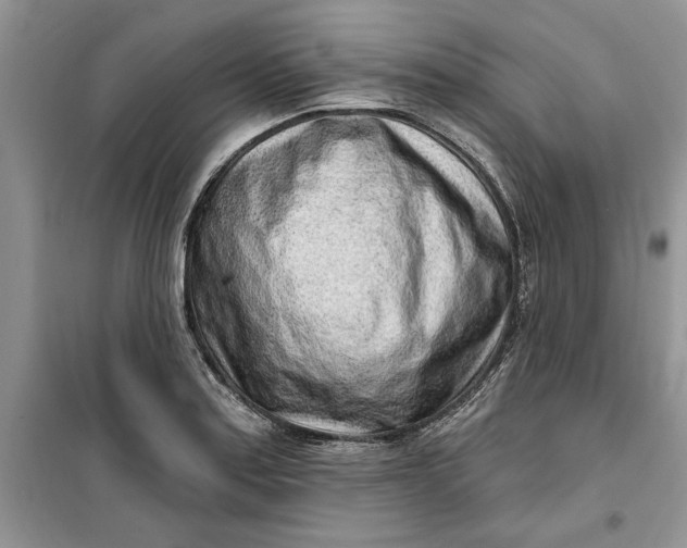 X0000099521179200805291205