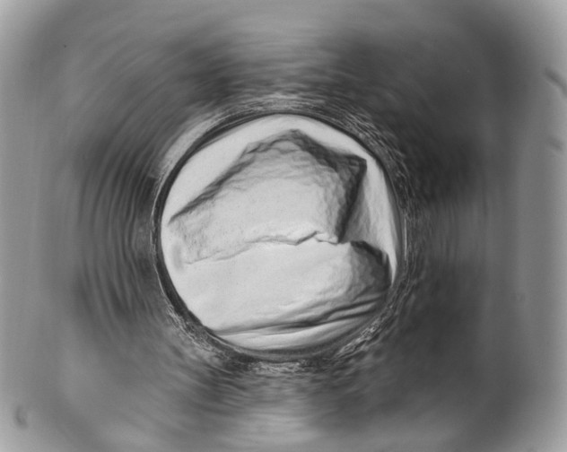 X0000099520147200806051219