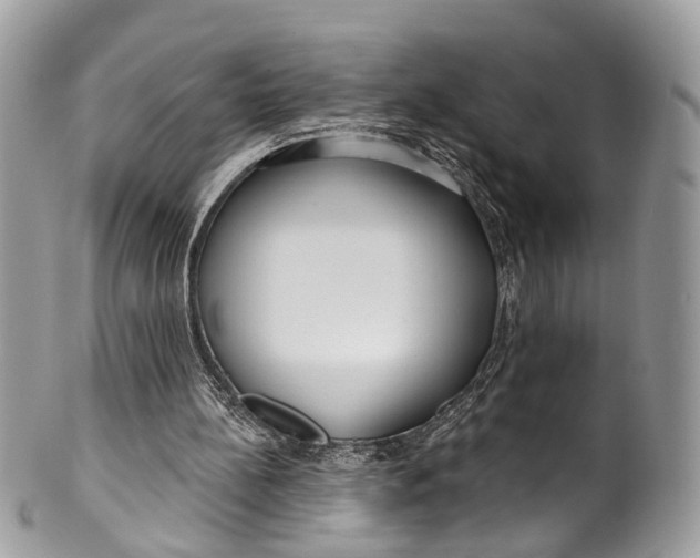 X0000099520148200806051219