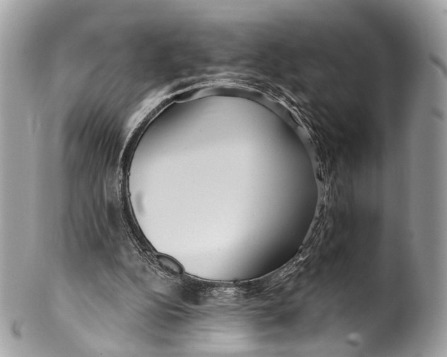 X0000099520152200806051219